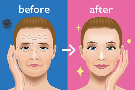 250K Photos Leaked in Cosmetic Surgery Extortion Attack