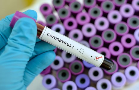 Two #RSAC Attendees Test Positive for #Coronavirus
