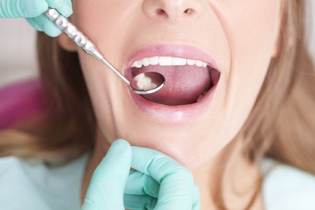 One Million US Dental Patients Impacted by Data Breach