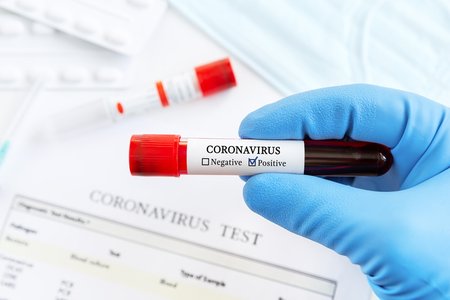 FBI Investigates COVID-19 Patient Data Breach