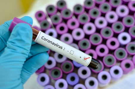 Cyber-criminals Lure Victims with Coronavirus Cure Conspiracy Theories