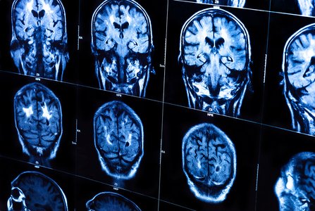 Healthcare the Top-Targeted Vertical for Cybercrime